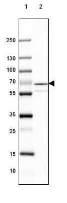 Western Blot: GAD1/GAD67 Antibody (CL2911) [NBP2-46637]