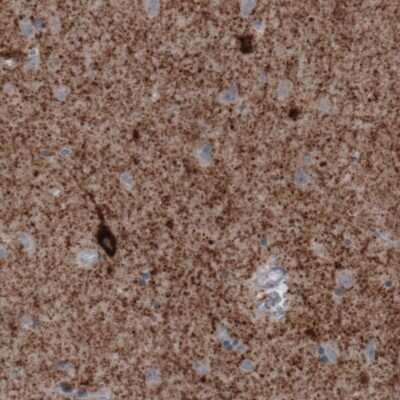 Immunohistochemistry-Paraffin: GAD1/GAD67 Antibody (CL2914) [NBP2-46638]