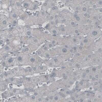 Immunohistochemistry-Paraffin: GAD1/GAD67 Antibody (CL2914) [NBP2-46638]