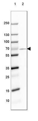 Western Blot: GAD1/GAD67 Antibody (CL2914) [NBP2-46638]