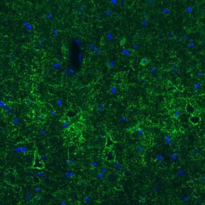 Immunohistochemistry: GAD1/GAD67 Antibody (CL2919) [NBP2-46639]
