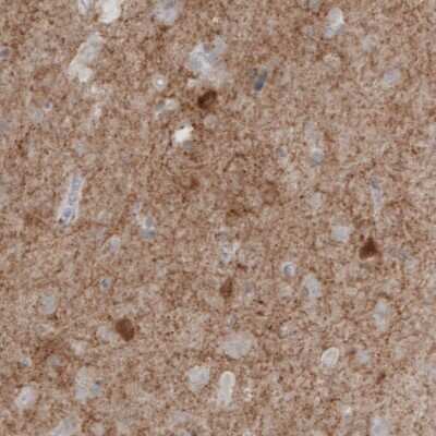 Immunohistochemistry: GAD1/GAD67 Antibody (CL2919) [NBP2-46639]