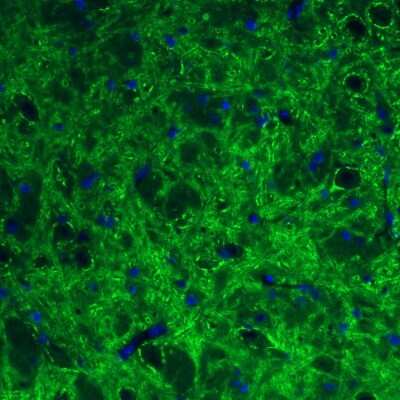 Immunohistochemistry: GAD1/GAD67 Antibody (CL2919) [NBP2-46639]