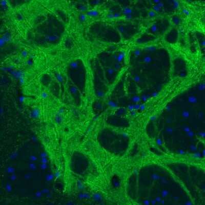 Immunohistochemistry: GAD1/GAD67 Antibody (CL2919) [NBP2-46639]