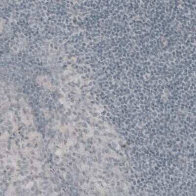 Immunohistochemistry: GAD1/GAD67 Antibody (CL2919) [NBP2-46639]