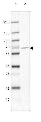 Western Blot: GAD1/GAD67 Antibody (CL2919) [NBP2-46639]
