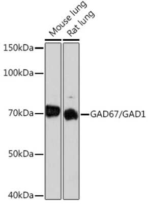 Western Blot: GAD1/GAD67 Antibody (4I8S8) [NBP3-15480]