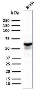 Western Blot: GAD1/GAD67 Antibody (GAD1/2391) [NBP3-07357]