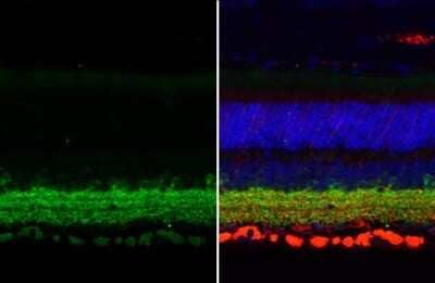 Immunohistochemistry-Paraffin: GAD1/GAD67 Antibody (HL1096) [NBP3-13716]