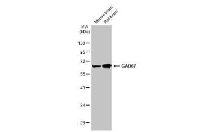 Western Blot: GAD1/GAD67 Antibody (HL1096) [NBP3-13716]