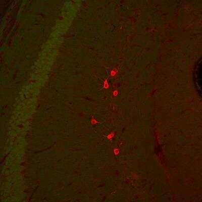 Immunocytochemistry/ Immunofluorescence: GAD1/GAD67 Antibody [NBP1-02161]