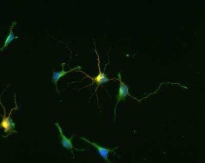 Immunocytochemistry/ Immunofluorescence: GAD1/GAD67 Antibody [NBP1-02161]