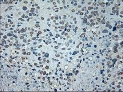 Immunohistochemistry: GAD1/GAD67 Antibody (OTI3G9) - Azide and BSA Free [NBP2-70791]