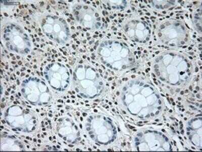 Immunohistochemistry: GAD1/GAD67 Antibody (OTI3G9) - Azide and BSA Free [NBP2-70791]