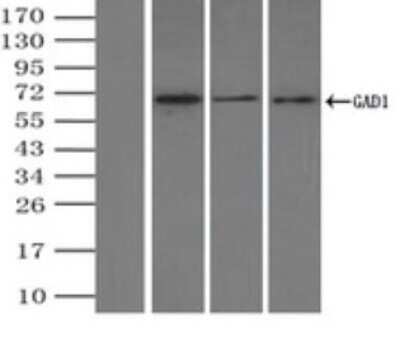 Immunoprecipitation: GAD1/GAD67 Antibody (OTI3G9) - Azide and BSA Free [NBP2-70791]