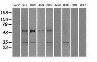 Western Blot: GAD1/GAD67 Antibody (OTI3G9)Azide and BSA Free [NBP2-70791]