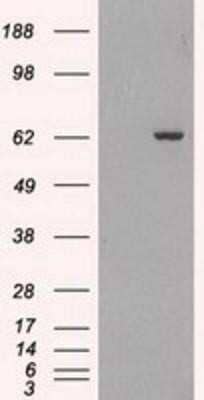 Western Blot: GAD1/GAD67 Antibody (OTI3G9)Azide and BSA Free [NBP2-70791]