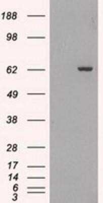 Western Blot: GAD1/GAD67 Antibody (OTI3G9) [NBP1-48272]