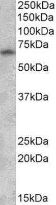 Western Blot: GAD1/GAD67 Antibody [NBP1-06989]