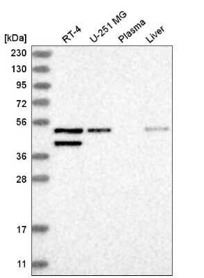 Western Blot: GAD1/GAD67 Antibody [NBP2-58132]