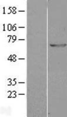 Western Blot: GAD1/GAD67 Overexpression Lysate [NBL1-10933]