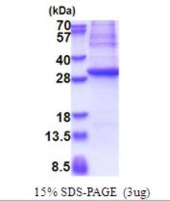 SDS-PAGE: Recombinant Human GAD1/GAD67 His Protein [NBP2-51655]