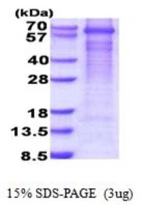 SDS-PAGE: Recombinant Human GAD1/GAD67 His Protein [NBP2-51849]