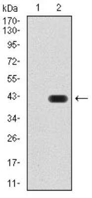 Western Blot: GAD2/GAD65 Antibody (5D9G12)BSA Free [NBP2-52471]