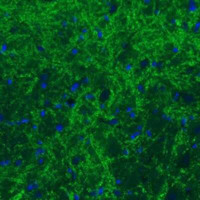 Immunohistochemistry: GAD2/GAD65 Antibody (CL2736) [NBP2-46629]