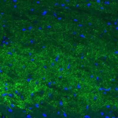 Immunohistochemistry: GAD2/GAD65 Antibody (CL2736) [NBP2-46629]