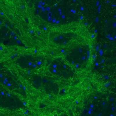 Immunohistochemistry: GAD2/GAD65 Antibody (CL2736) [NBP2-46629]