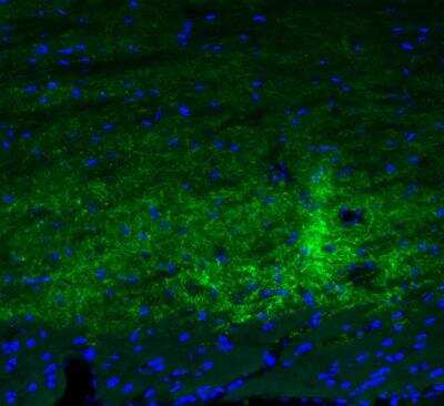 Immunohistochemistry: GAD2/GAD65 Antibody (CL2736) [NBP2-46629]
