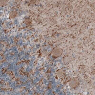 Immunohistochemistry-Paraffin: GAD2/GAD65 Antibody (CL2736) [NBP2-46629]