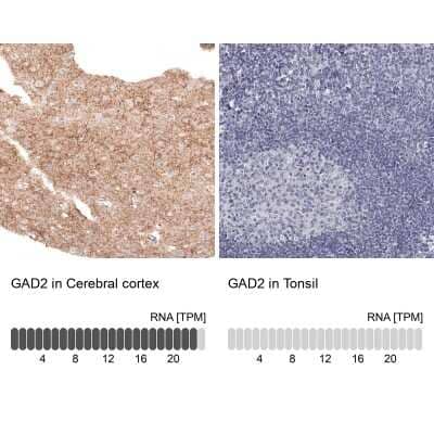 Immunohistochemistry-Paraffin: GAD2/GAD65 Antibody (CL2736) [NBP2-46629]