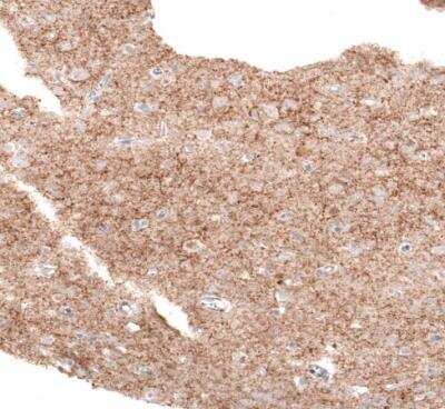 Immunohistochemistry-Paraffin: GAD2/GAD65 Antibody (CL2736) [NBP2-46629]