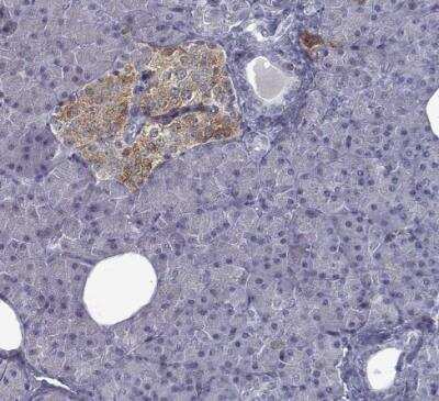 Immunohistochemistry-Paraffin: GAD2/GAD65 Antibody (CL2736) [NBP2-46629]