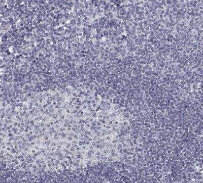 Immunohistochemistry-Paraffin: GAD2/GAD65 Antibody (CL2736) [NBP2-46629]