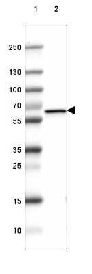 Western Blot: GAD2/GAD65 Antibody (CL2736) [NBP2-46629]