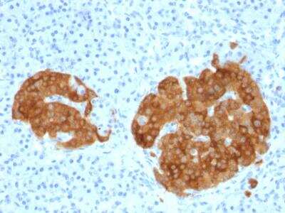 Immunohistochemistry-Paraffin: GAD2/GAD65 Antibody (GAD2/1960) - Azide and BSA Free [NBP2-79938]