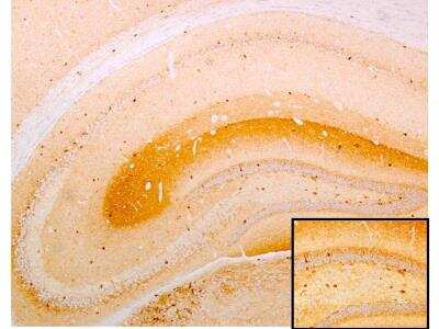 Immunohistochemistry-Paraffin: GAD2/GAD65 Antibody [NB110-41528]