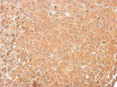 Immunohistochemistry-Paraffin: GAD2/GAD65 Antibody [NBP1-33284]