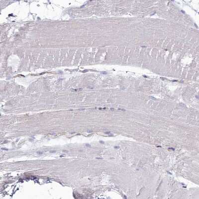 Immunohistochemistry-Paraffin: GAD2/GAD65 Antibody [NBP1-89801]