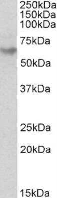 Western Blot: GAD2/GAD65 Antibody [NB100-1506]