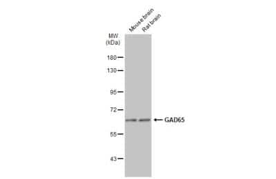 Western Blot: GAD2/GAD65 Antibody [NBP1-33284]