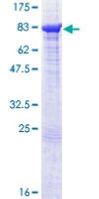 SDS-PAGE: Recombinant Human GAD2/GAD65 GST (N-Term) Protein [H00002572-P02]