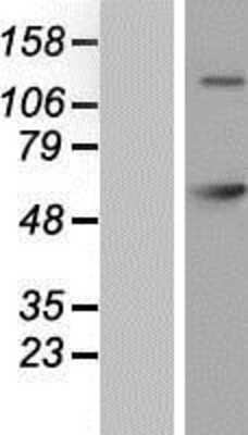 Western Blot: GAD2/GAD65 Overexpression Lysate [NBP2-10700]