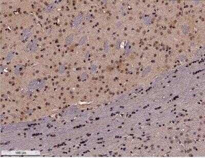 Immunohistochemistry-Paraffin: GADD153/CHOP Antibody (9C8) - Azide and BSA Free [NBP2-80745]