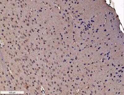Immunohistochemistry-Paraffin: GADD153/CHOP Antibody (9C8) - Azide and BSA Free [NBP2-80745]