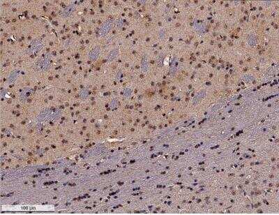 Immunohistochemistry-Paraffin: GADD153/CHOP Antibody (9C8) [NB600-1335]