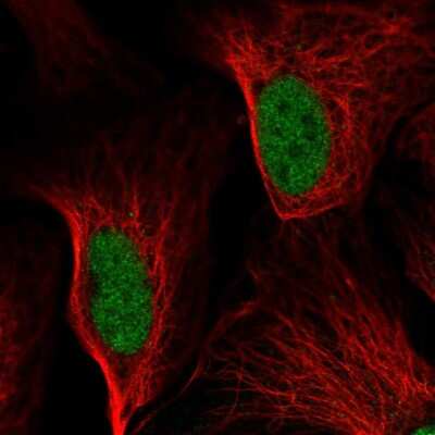 Immunocytochemistry/ Immunofluorescence: GADD153/CHOP Antibody [NBP2-58505]